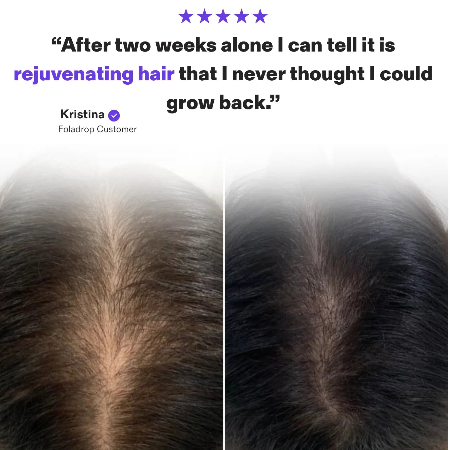 The Hair Growth Soft Chews®