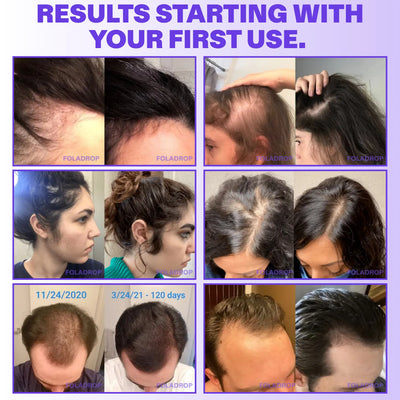 The Hair Growth Soft Chews®